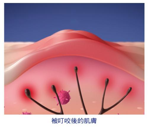 模範堂MUHI-無比止癢消炎液-50ml