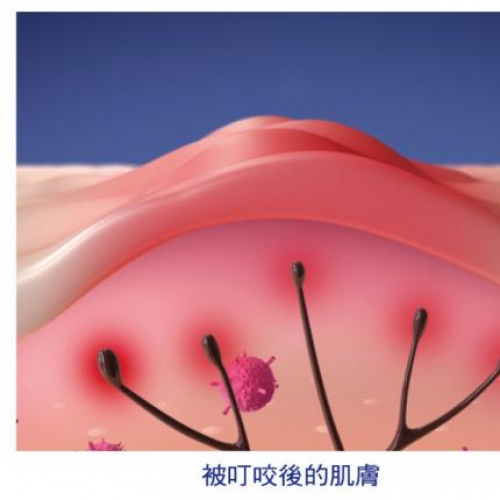 模範堂MUHI-無比止癢消炎液-50ml